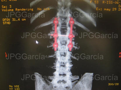 JPGGarcía JPGGarcía JPGGarcía JPGGarcía JPGGarcía JPGGarcía JPGGarcía JPGGarcía