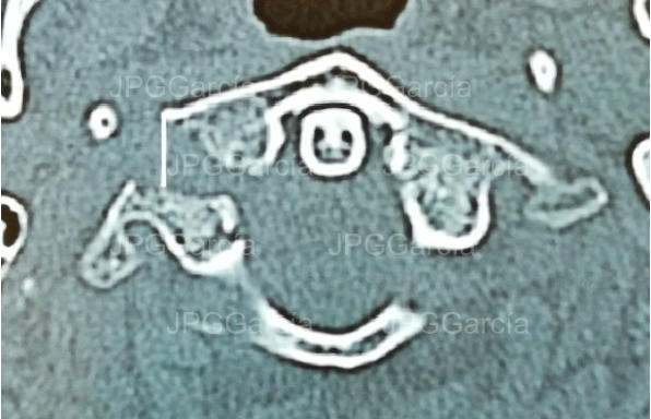 JPGGarcía JPGGarcía JPGGarcía JPGGarcía JPGGarcía JPGGarcía JPGGarcía JPGGarcía