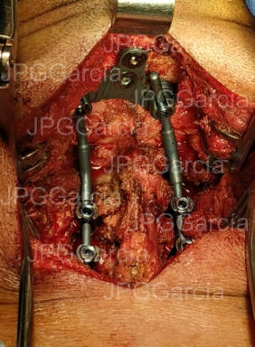 JPGGarcía JPGGarcía JPGGarcía JPGGarcía JPGGarcía JPGGarcía JPGGarcía JPGGarcía JPGGarcía