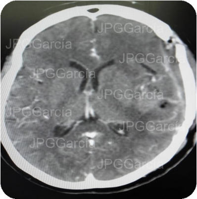 JPGGarcía JPGGarcía JPGGarcía JPGGarcía JPGGarcía JPGGarcía JPGGarcía JPGGarcía JPGGarcía