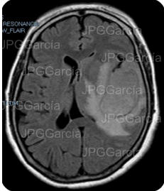 JPGGarcía JPGGarcía JPGGarcía JPGGarcía JPGGarcía JPGGarcía JPGGarcía JPGGarcía JPGGarcía