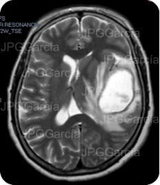 JPGGarcía JPGGarcía JPGGarcía JPGGarcía JPGGarcía JPGGarcía JPGGarcía JPGGarcía JPGGarcía