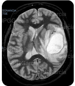 JPGGarcía JPGGarcía JPGGarcía JPGGarcía JPGGarcía JPGGarcía JPGGarcía JPGGarcía JPGGarcía