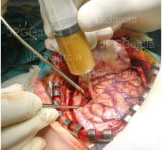 JPGGarcía JPGGarcía JPGGarcía JPGGarcía JPGGarcía JPGGarcía JPGGarcía JPGGarcía JPGGarcía