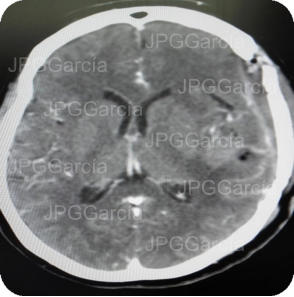 JPGGarcía JPGGarcía JPGGarcía JPGGarcía JPGGarcía JPGGarcía JPGGarcía JPGGarcía JPGGarcía