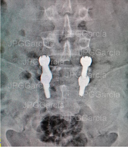 JPGGarcía JPGGarcía JPGGarcía JPGGarcía JPGGarcía JPGGarcía JPGGarcía JPGGarcía JPGGarcía
