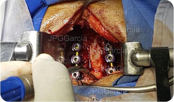 JPGGarcía JPGGarcía JPGGarcía JPGGarcía JPGGarcía JPGGarcía JPGGarcía JPGGarcía JPGGarcía