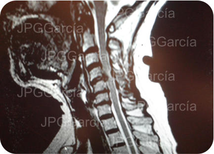 JPGGarcía JPGGarcía JPGGarcía JPGGarcía JPGGarcía JPGGarcía JPGGarcía JPGGarcía JPGGarcía