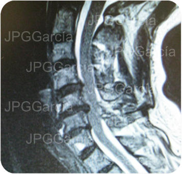 JPGGarcía JPGGarcía JPGGarcía JPGGarcía JPGGarcía JPGGarcía JPGGarcía JPGGarcía JPGGarcía