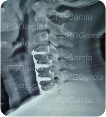 JPGGarcía JPGGarcía JPGGarcía JPGGarcía JPGGarcía JPGGarcía JPGGarcía JPGGarcía JPGGarcía