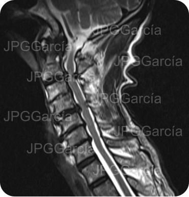 JPGGarcía JPGGarcía JPGGarcía JPGGarcía JPGGarcía JPGGarcía JPGGarcía JPGGarcía JPGGarcía