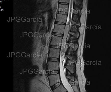 JPGGarcía JPGGarcía JPGGarcía JPGGarcía JPGGarcía JPGGarcía JPGGarcía JPGGarcía JPGGarcía