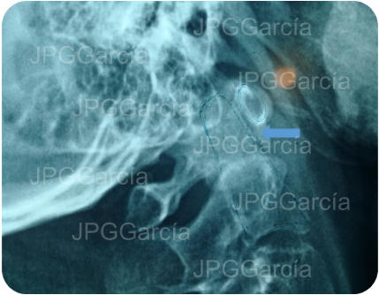 JPGGarcía JPGGarcía JPGGarcía JPGGarcía JPGGarcía JPGGarcía JPGGarcía JPGGarcía JPGGarcía