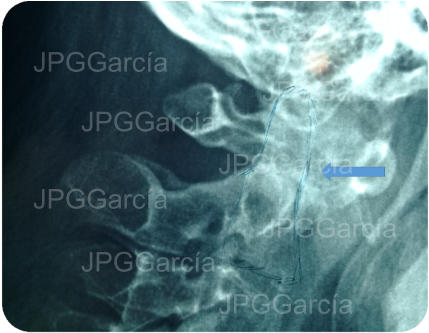 JPGGarcía JPGGarcía JPGGarcía JPGGarcía JPGGarcía JPGGarcía JPGGarcía JPGGarcía JPGGarcía