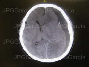 JPGGarcía JPGGarcía JPGGarcía JPGGarcía JPGGarcía JPGGarcía JPGGarcía JPGGarcía