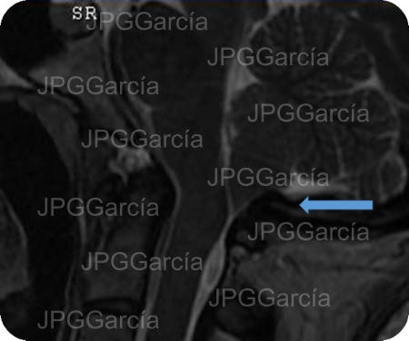 JPGGarcía JPGGarcía JPGGarcía JPGGarcía JPGGarcía JPGGarcía JPGGarcía JPGGarcía JPGGarcía JPGGarcía JPGGarcía
