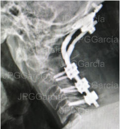 JPGGarcía JPGGarcía JPGGarcía JPGGarcía JPGGarcía JPGGarcía JPGGarcía JPGGarcía JPGGarcía