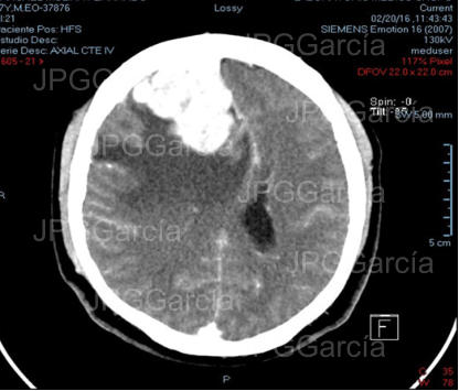 JPGGarcía JPGGarcía JPGGarcía JPGGarcía JPGGarcía JPGGarcía JPGGarcía JPGGarcía JPGGarcía