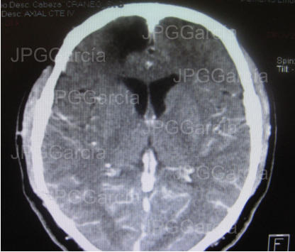 JPGGarcía JPGGarcía JPGGarcía JPGGarcía JPGGarcía JPGGarcía JPGGarcía JPGGarcía JPGGarcía