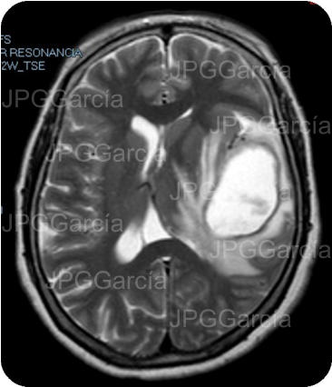 JPGGarcía JPGGarcía JPGGarcía JPGGarcía JPGGarcía JPGGarcía JPGGarcía JPGGarcía JPGGarcía