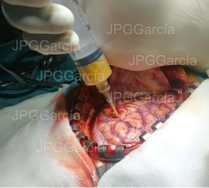 JPGGarcía JPGGarcía JPGGarcía JPGGarcía JPGGarcía JPGGarcía JPGGarcía JPGGarcía JPGGarcía