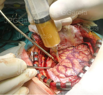 JPGGarcía JPGGarcía JPGGarcía JPGGarcía JPGGarcía JPGGarcía JPGGarcía JPGGarcía JPGGarcía