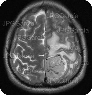 JPGGarcía JPGGarcía JPGGarcía JPGGarcía JPGGarcía JPGGarcía JPGGarcía JPGGarcía JPGGarcía