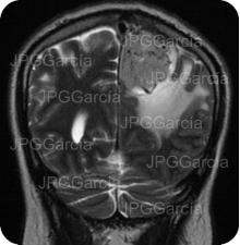 JPGGarcía JPGGarcía JPGGarcía JPGGarcía JPGGarcía JPGGarcía JPGGarcía JPGGarcía JPGGarcía