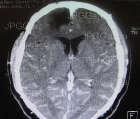 JPGGarcía JPGGarcía JPGGarcía JPGGarcía JPGGarcía JPGGarcía JPGGarcía JPGGarcía JPGGarcía