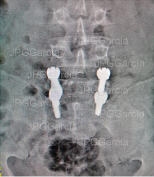 JPGGarcía JPGGarcía JPGGarcía JPGGarcía JPGGarcía JPGGarcía JPGGarcía JPGGarcía JPGGarcía