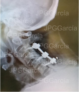 JPGGarcía JPGGarcía JPGGarcía JPGGarcía JPGGarcía JPGGarcía JPGGarcía JPGGarcía JPGGarcía