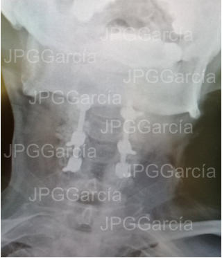 JPGGarcía JPGGarcía JPGGarcía JPGGarcía JPGGarcía JPGGarcía JPGGarcía JPGGarcía JPGGarcía