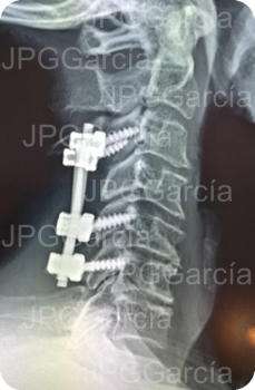 JPGGarcía JPGGarcía JPGGarcía JPGGarcía JPGGarcía JPGGarcía JPGGarcía JPGGarcía JPGGarcía