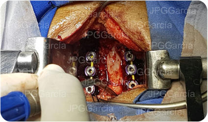 JPGGarcía JPGGarcía JPGGarcía JPGGarcía JPGGarcía JPGGarcía JPGGarcía JPGGarcía JPGGarcía JPGGarcía JPGGarcía JPGGarcía JPGGarcía JPGGarcía JPGGarcía