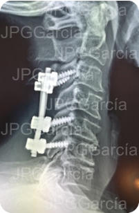 JPGGarcía JPGGarcía JPGGarcía JPGGarcía JPGGarcía JPGGarcía JPGGarcía JPGGarcía JPGGarcía