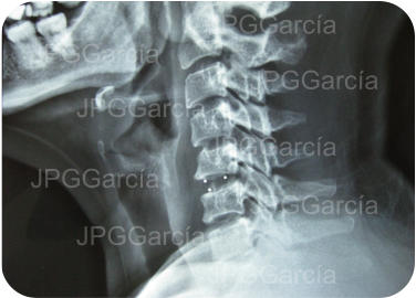 JPGGarcía JPGGarcía JPGGarcía JPGGarcía JPGGarcía JPGGarcía JPGGarcía JPGGarcía JPGGarcía