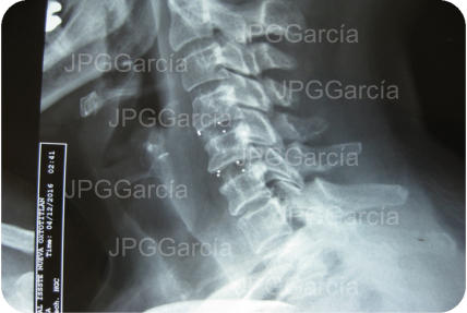 JPGGarcía JPGGarcía JPGGarcía JPGGarcía JPGGarcía JPGGarcía JPGGarcía JPGGarcía JPGGarcía