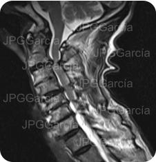 JPGGarcía JPGGarcía JPGGarcía JPGGarcía JPGGarcía JPGGarcía JPGGarcía JPGGarcía JPGGarcía