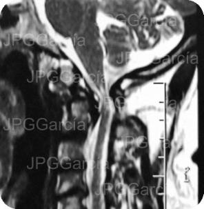 JPGGarcía JPGGarcía JPGGarcía JPGGarcía JPGGarcía JPGGarcía JPGGarcía JPGGarcía JPGGarcía