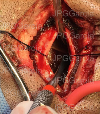 JPGGarcía JPGGarcía JPGGarcía JPGGarcía JPGGarcía JPGGarcía JPGGarcía JPGGarcía JPGGarcía