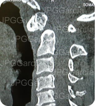 JPGGarcía JPGGarcía JPGGarcía JPGGarcía JPGGarcía JPGGarcía JPGGarcía JPGGarcía JPGGarcía