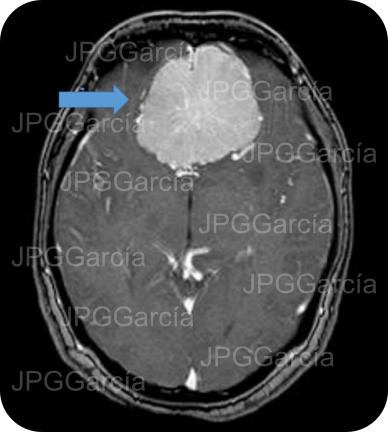 JPGGarcía JPGGarcía JPGGarcía JPGGarcía JPGGarcía JPGGarcía JPGGarcía JPGGarcía JPGGarcía JPGGarcía JPGGarcía