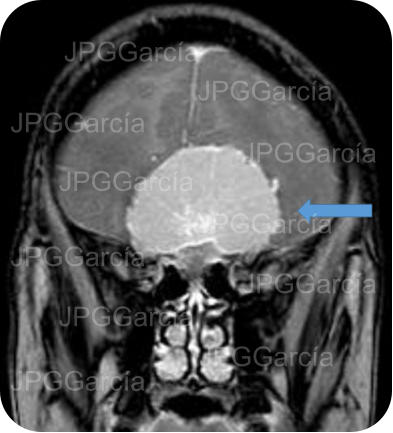 JPGGarcía JPGGarcía JPGGarcía JPGGarcía JPGGarcía JPGGarcía JPGGarcía JPGGarcía JPGGarcía JPGGarcía JPGGarcía