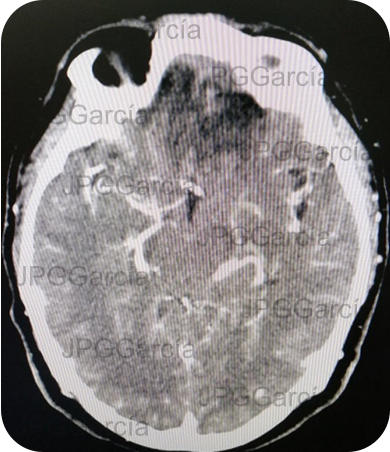 JPGGarcía JPGGarcía JPGGarcía JPGGarcía JPGGarcía JPGGarcía JPGGarcía JPGGarcía JPGGarcía JPGGarcía JPGGarcía