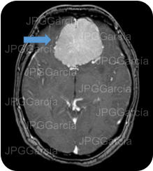 JPGGarcía JPGGarcía JPGGarcía JPGGarcía JPGGarcía JPGGarcía JPGGarcía JPGGarcía JPGGarcía JPGGarcía JPGGarcía