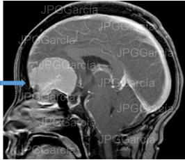JPGGarcía JPGGarcía JPGGarcía JPGGarcía JPGGarcía JPGGarcía JPGGarcía JPGGarcía JPGGarcía JPGGarcía JPGGarcía