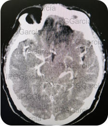 JPGGarcía JPGGarcía JPGGarcía JPGGarcía JPGGarcía JPGGarcía JPGGarcía JPGGarcía JPGGarcía JPGGarcía JPGGarcía